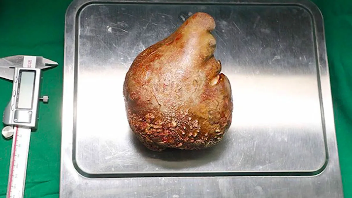 46 Medical Facts So Unusual Most People Never Learn Them