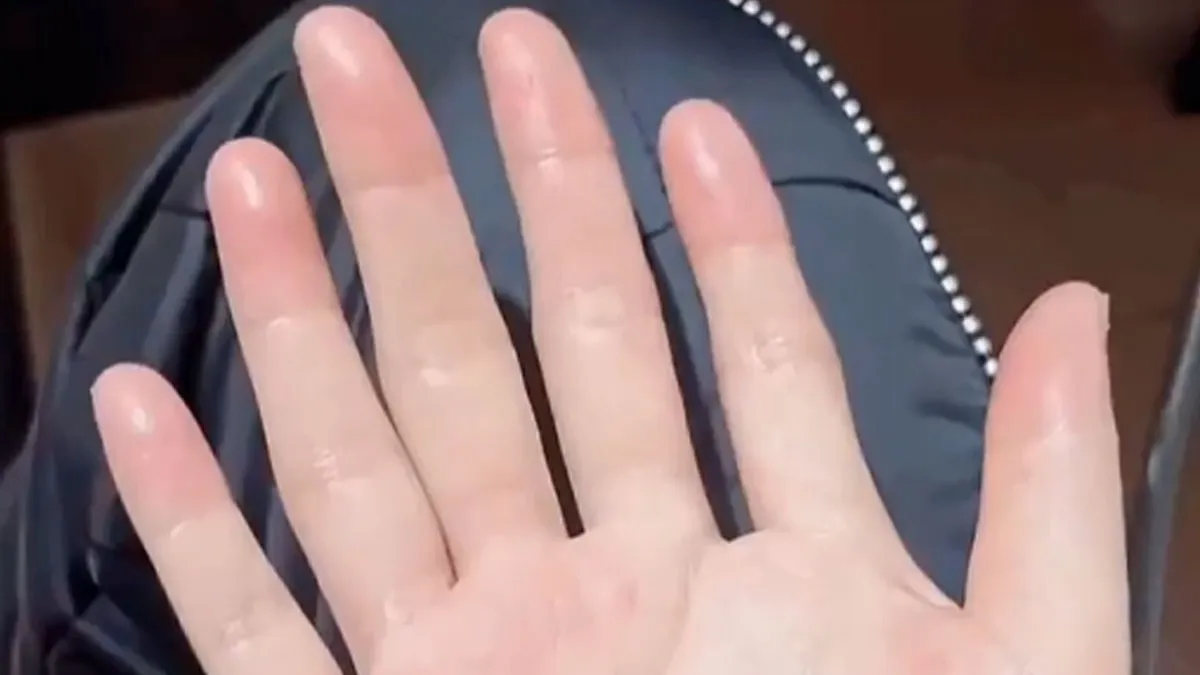 “It’s A Sight I’ll Never Forget”: 50 Unique Physical Features That Fascinated People