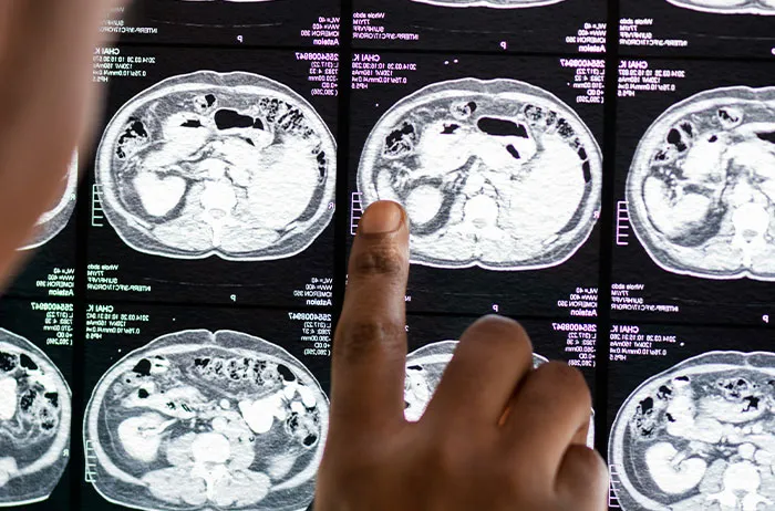“Depression Levels Correlate With Intelligence”: 48 Facts People Wish They Didn’t Know