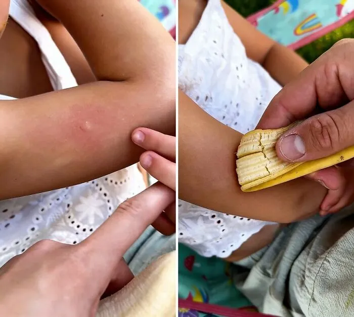 Banana Peels for Mosquito Bites