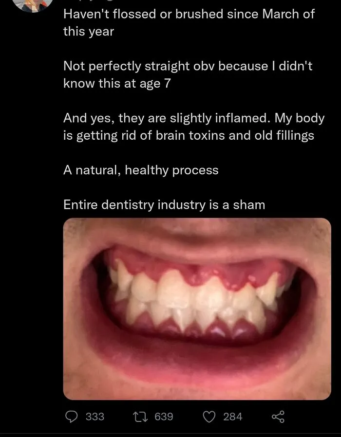 Close-up of crooked, inflamed teeth with a tweet claiming dental health is a sham, illustrating dumb social media posts.