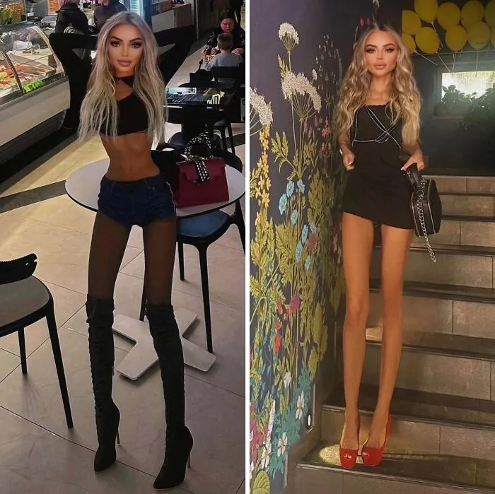 Legs For Days?