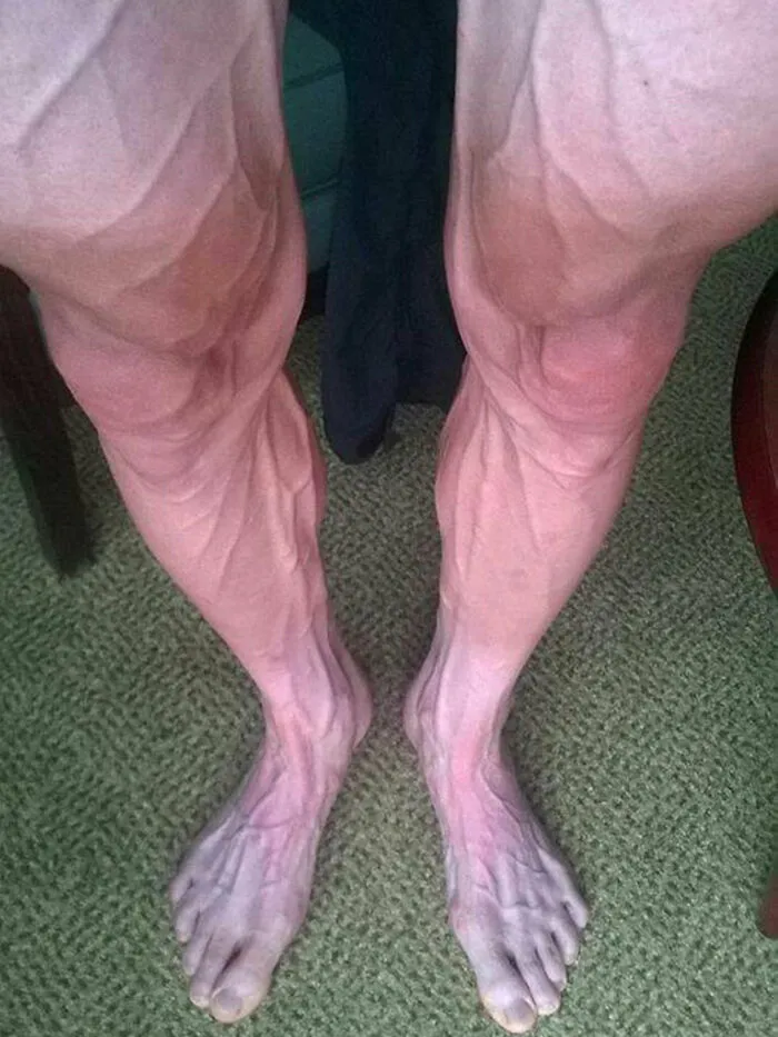 Las piernas de un ciclista tras una etapa del Tour de Francia.