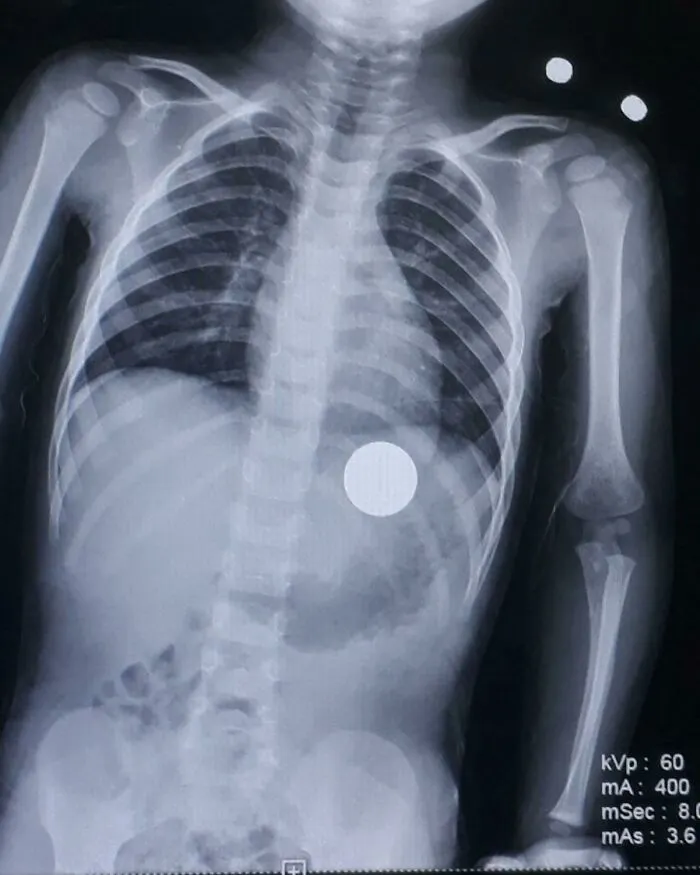 40 Autopsy Doctors Share The Most Bizarre Cases They’ve Ever Seen