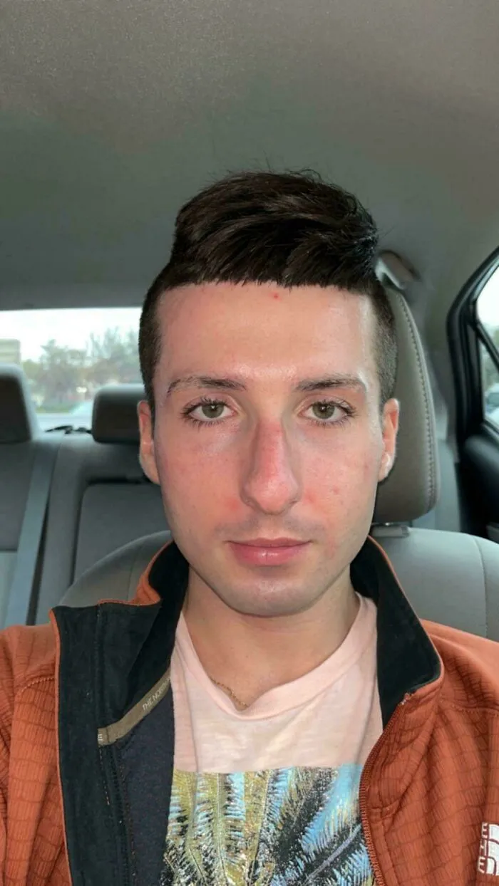 Young man with a tragic hair accident showing uneven and unusually styled haircut inside a car seat.