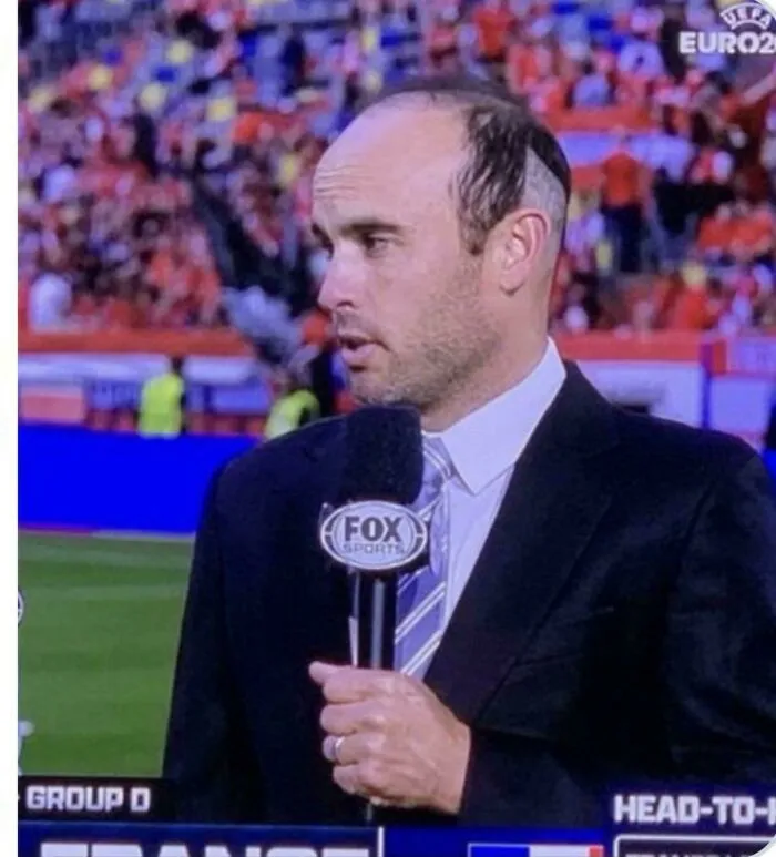 Man with a tragic hair accident on live sports broadcast, showing a poorly done uneven haircut by hairstylist.