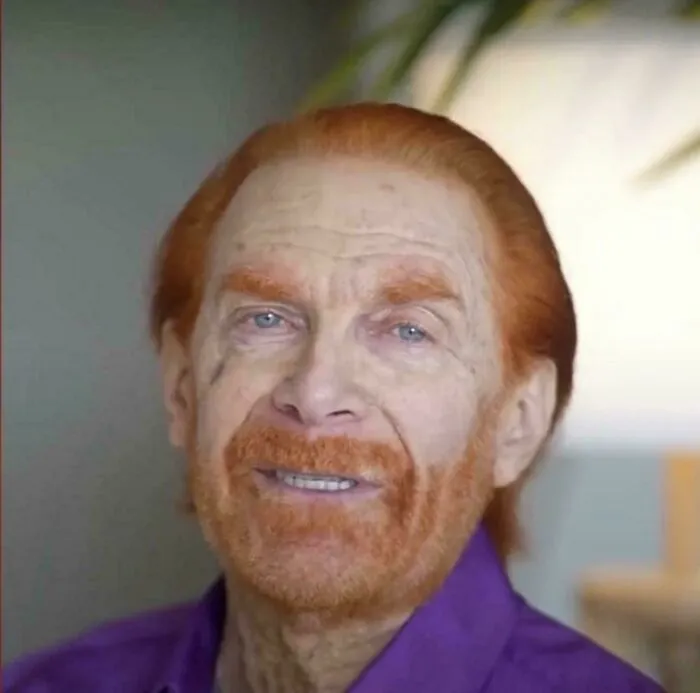 Elderly man with unevenly dyed red hair and beard, an example of tragic hair accidents from hairstylist errors.