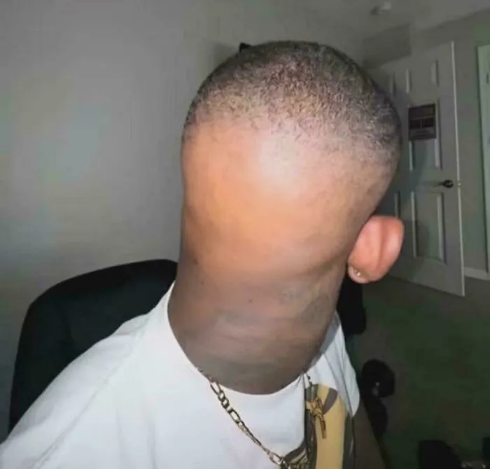 Man with an extreme hair accident showing an unusual haircut with a distorted neck and short hair.