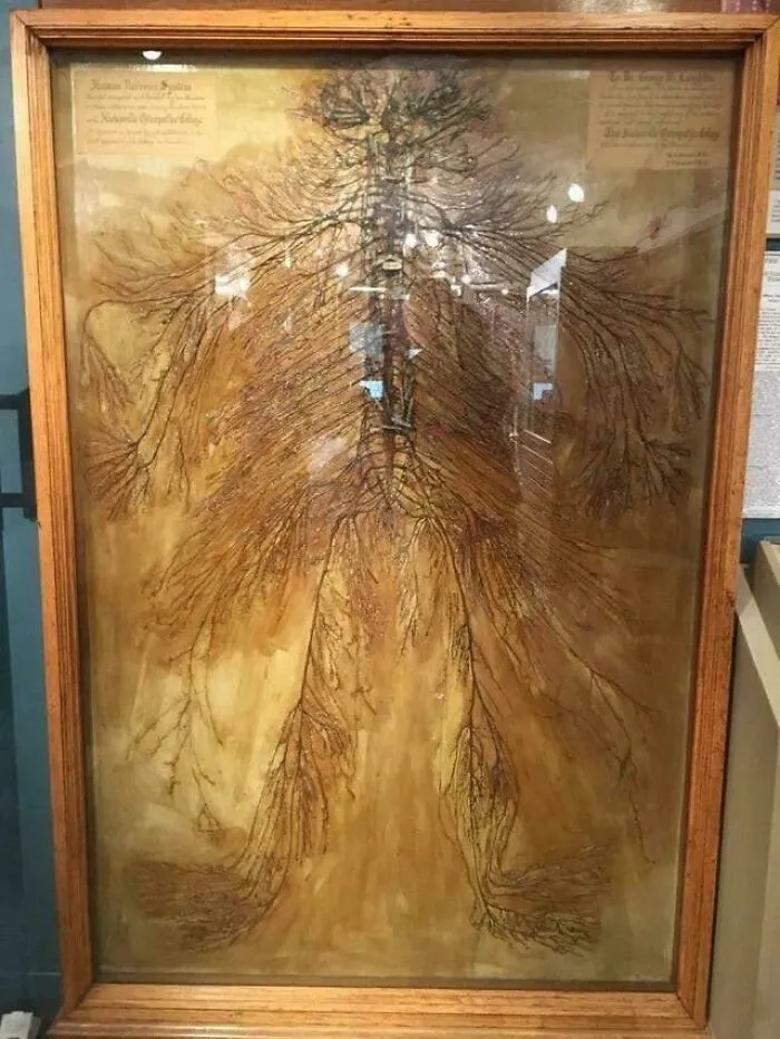 This Is An Intact Human Nervous System Dissected By 2 Medical Students In 1925. It Took Them Over 1,500 Hours. There Are Only 4 Of These In The World
