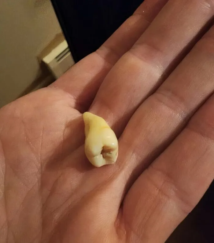 I Have Found 4 Adult Teeth With Roots In My Home Since Moving In 2 Years Ago