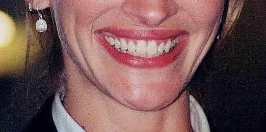 Close-up of a celebrity smile showing teeth and lips for a guess the celebrity from their mouth challenge.