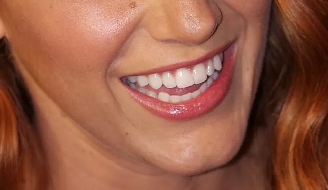 Close-up of a smiling mouth and lips with bright teeth, part of a guess the celebrity from their mouth challenge.