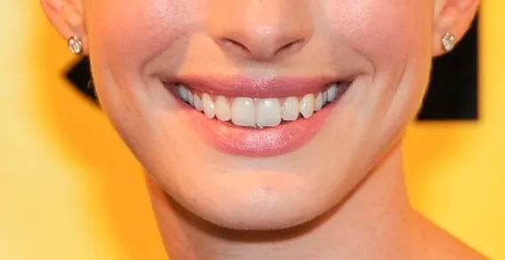 Close-up of a smiling mouth in the Guess The Celebrity From Their Mouth challenge, part 3, showing bright teeth and lips.