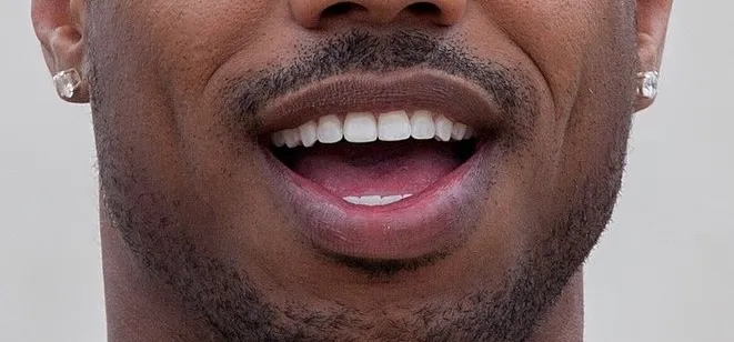 Close-up of a male celebrity's mouth showing teeth and lips for guess the celebrity challenge part 3.