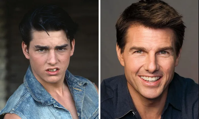 Tom Cruise