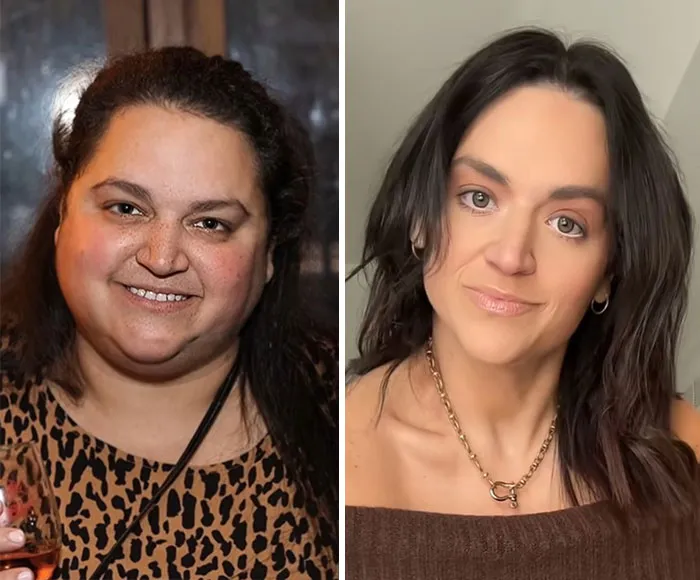 33 Personas comparten los drásticos cambios faciales que experimentaron durante su tratamiento con Ozempic