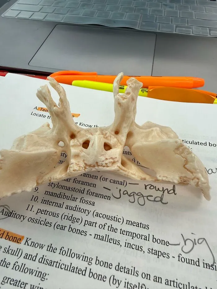This Little Guy Is An Underside View Of A Bone Found In The Human Skull, Called The Sphenoid. Discovered Him In My Anatomy Lab. Too Cute Not To Share
