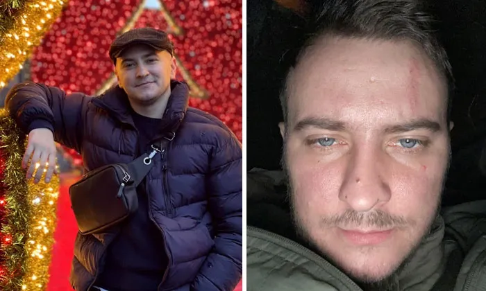 40 Ukrainian Soldiers Reveal How War Transformed Them In Striking Before-And-After Photos