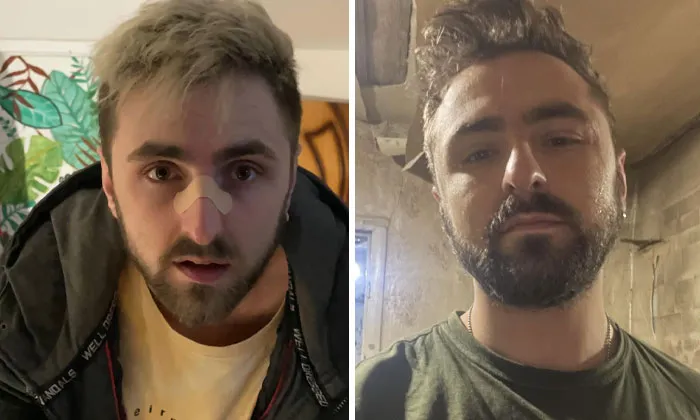 Before and after photos of a Ukrainian soldier showing changes in appearance during the war experience.