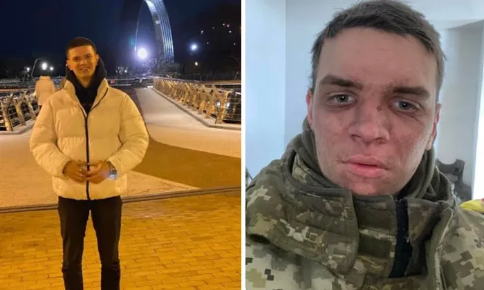 40 Ukrainian Soldiers Reveal How War Transformed Them In Striking Before-And-After Photos