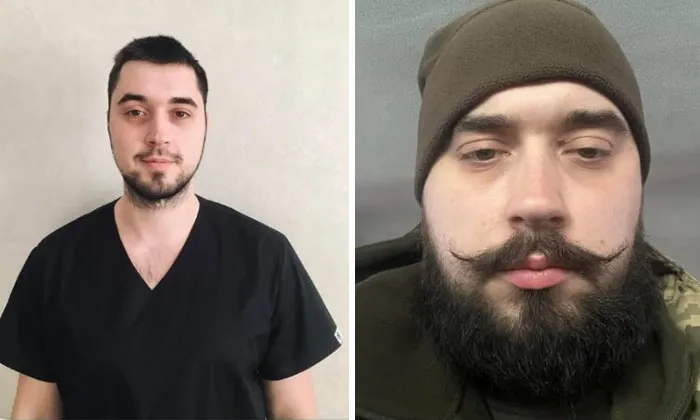 Before-and-after photos of a Ukrainian soldier showing changes in appearance during the war.