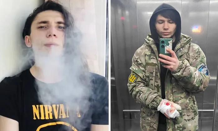 Before-and-after photos of a Ukrainian soldier showing transformation amid the war, wearing military gear with an injured hand.