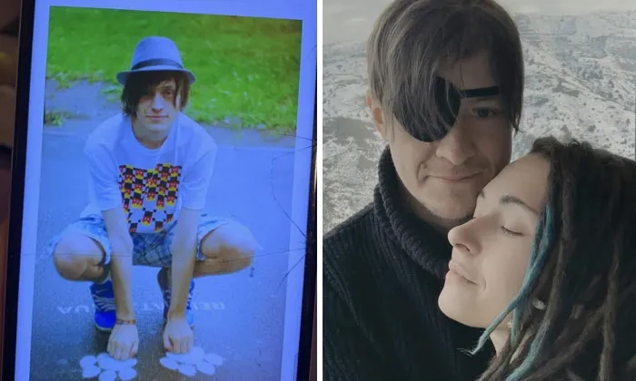 40 Ukrainian Soldiers Reveal How War Transformed Them In Striking Before-And-After Photos