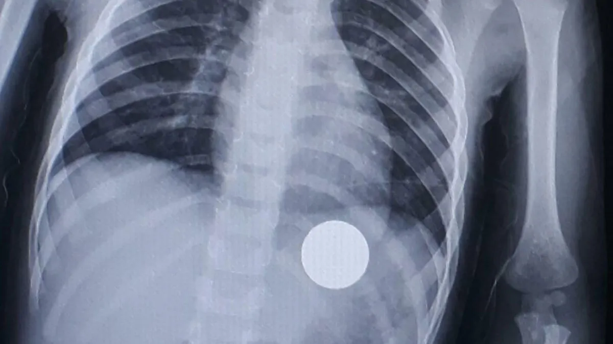 40 Autopsy Doctors Share The Most Bizarre Cases They’ve Ever Seen