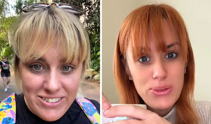 Before and after photos showing dramatic facial changes from an Ozempic journey shared by users.
