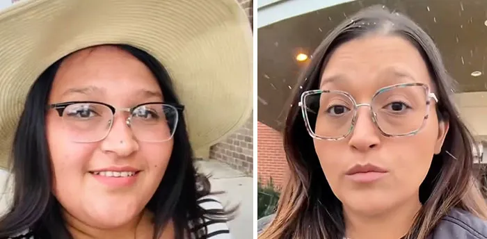 Before and after photos of a woman showing dramatic facial changes from her Ozempic journey and Ozempic face transformation.