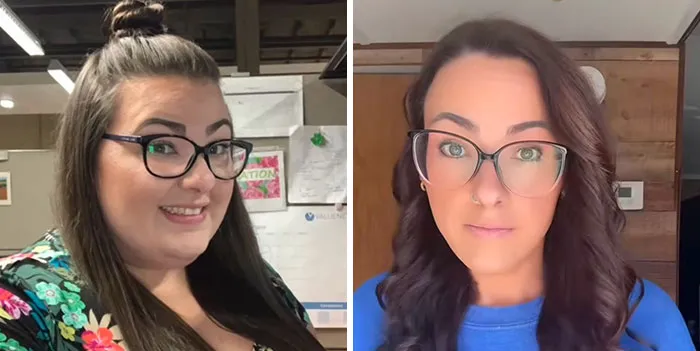 Before and after photos of a woman showing dramatic facial changes from her Ozempic face journey.