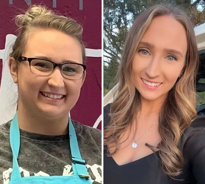 Before and after photos showing dramatic facial changes from the Ozempic face transformation journey.