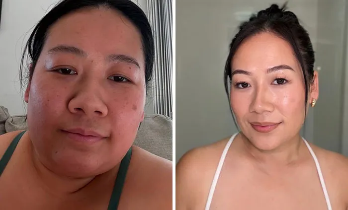 33 Personas comparten los drásticos cambios faciales que experimentaron durante su tratamiento con Ozempic