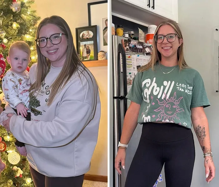 Before and after photos showing dramatic facial changes and weight loss during an Ozempic journey for facial transformation.