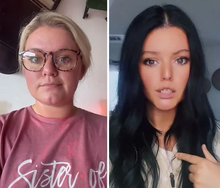 Before and after portraits showing dramatic facial changes from the Ozempic face journey shared by users.