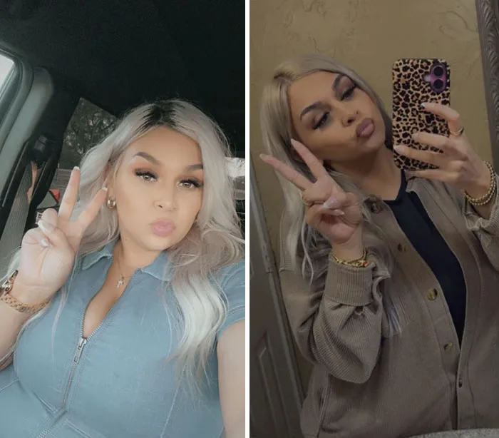 Side-by-side selfies of a woman showing dramatic facial changes from her Ozempic face journey with peace signs and pursed lips.