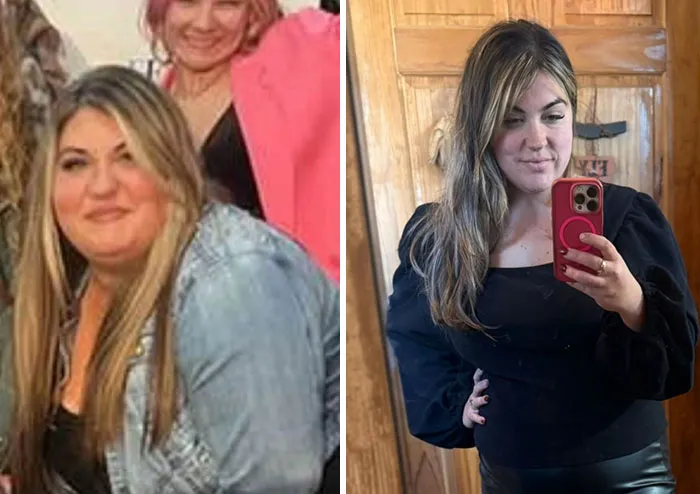 Before and after photos showing dramatic facial changes from the Ozempic face transformation journey.