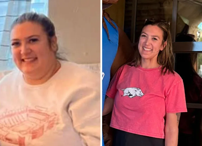 Before and after photos showing dramatic facial changes from the Ozempic face transformation journey.