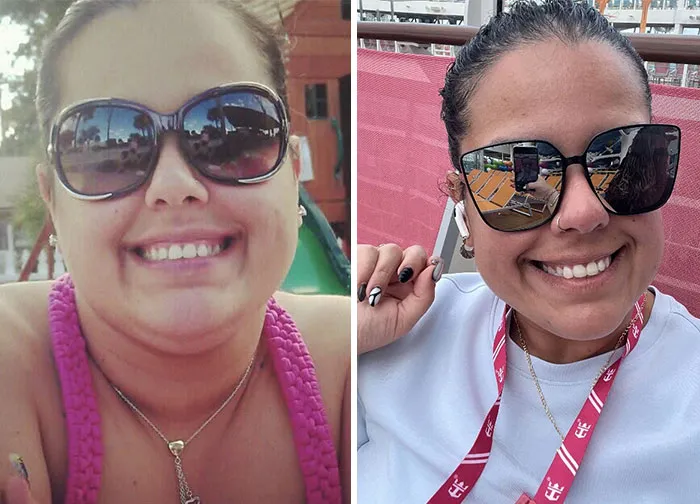 Before and after photos showing dramatic facial changes from an Ozempic journey with noticeable weight loss and slimmer face.