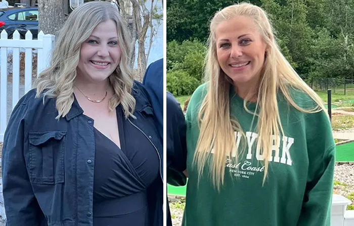 Before and after photos showing dramatic facial changes in women during their Ozempic journey with noticeable weight loss and slimmer faces.