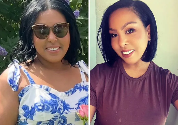 Before and after photos showing dramatic facial changes during an Ozempic journey with noticeable slimming effects.