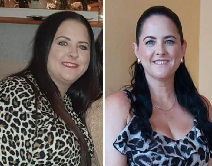 Before and after portraits of a woman showing dramatic facial changes during her Ozempic journey with noticeable weight loss effects.