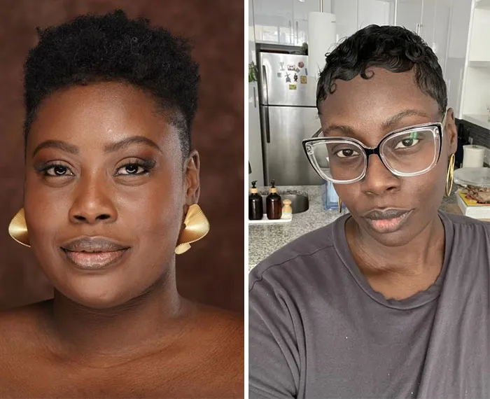 Side-by-side photos showing dramatic facial changes from the Ozempic face journey in before and after comparison.