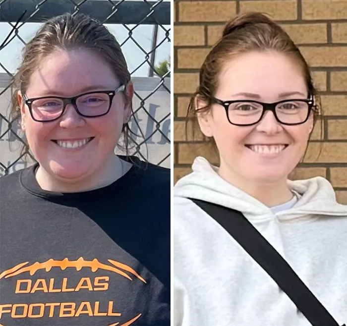 Side-by-side photos of a woman showing dramatic facial changes from her Ozempic journey with noticeable weight loss.