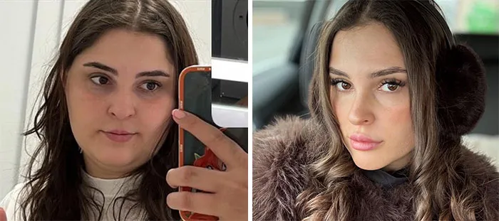 33 Personas comparten los drásticos cambios faciales que experimentaron durante su tratamiento con Ozempic