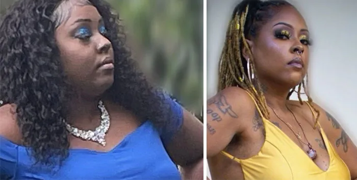 Before and after photos showing dramatic facial changes from the Ozempic face transformation journey in two women.