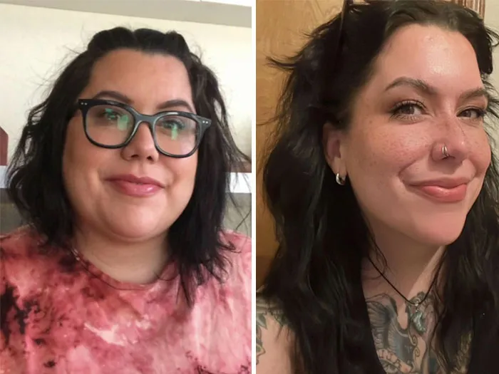 Before and after photos showing dramatic facial changes during an Ozempic journey with noticeable weight loss effects.
