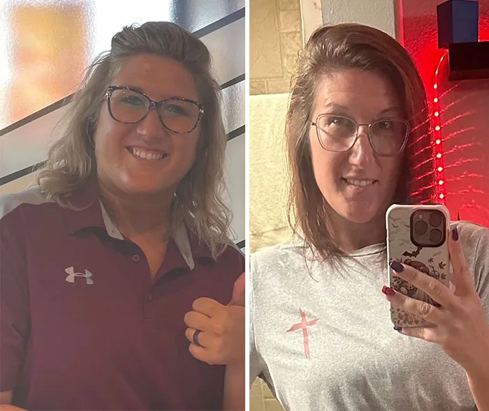 Before and after photos showing dramatic facial changes from Ozempic face during weight loss journey.