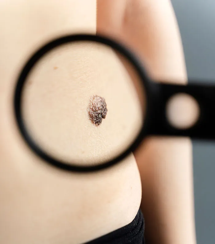 82 Signs Our Bodies Give Us That Can Actually Be Silent Cries For Help