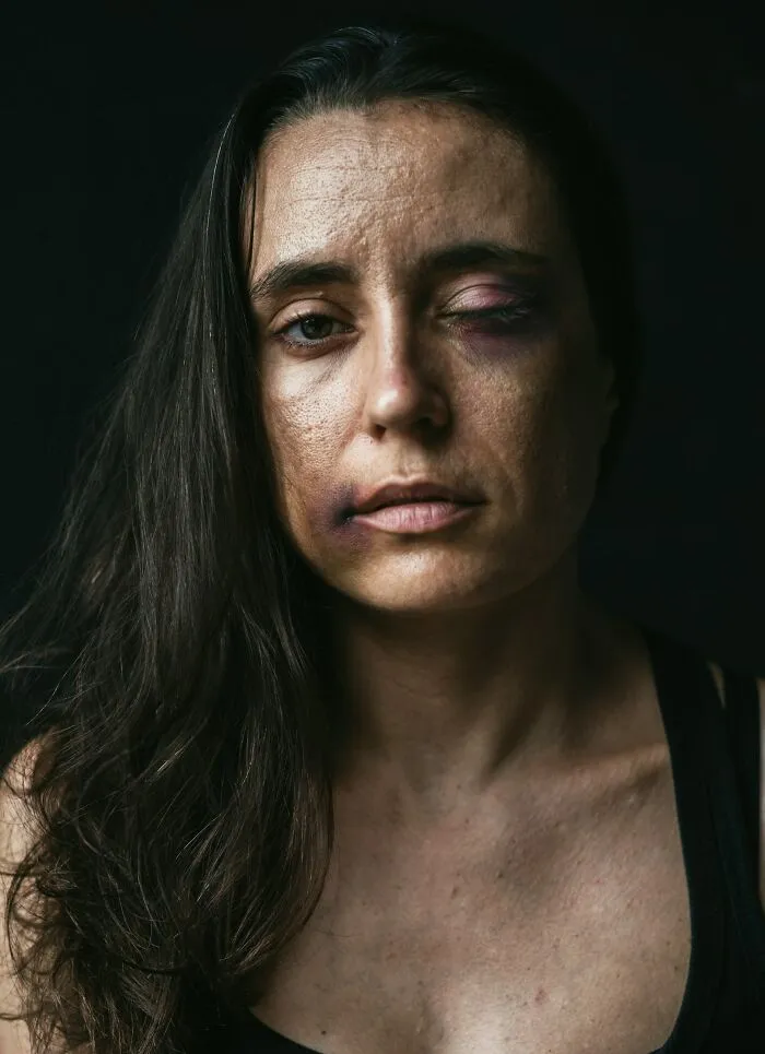 People Who Work With The Dead Shared The Most Traumatizing Things They Saw And Heard